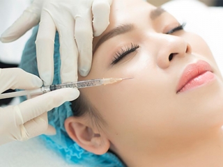 Tiêm Filler: Kiến Thức Chuyên Sâu Từ A-Z Về Chất Làm Đầy Thẩm Mỹ