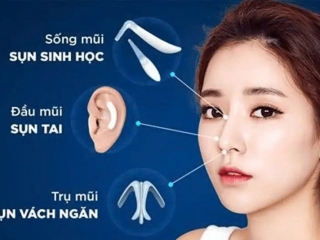 Nâng Mũi Cấu Trúc: Giải Pháp Kiến Tạo Dáng Mũi Đẹp Hoàn Hảo 