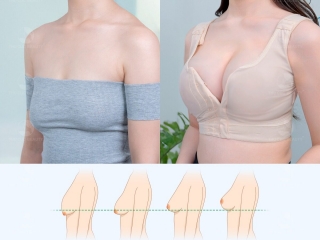 Treo Sa Trễ: Cẩm Nang Chuyên Sâu Về Phương Pháp & Giải Pháp Lấy Lại