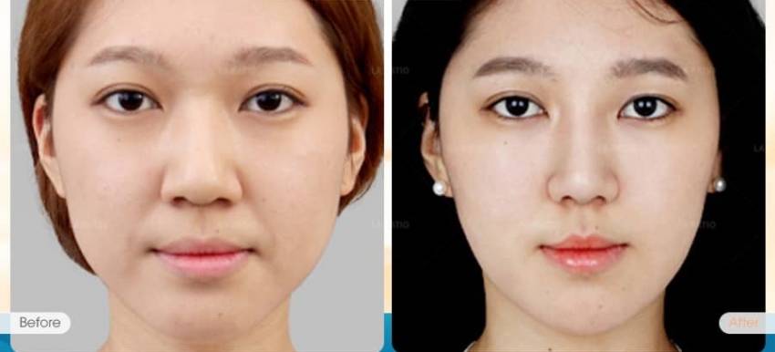 THẠC SĨ BÁC SĨ HUỲNH PHÁT