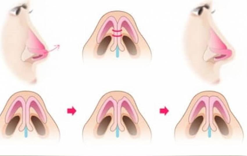 THẠC SĨ BÁC SĨ HUỲNH PHÁT