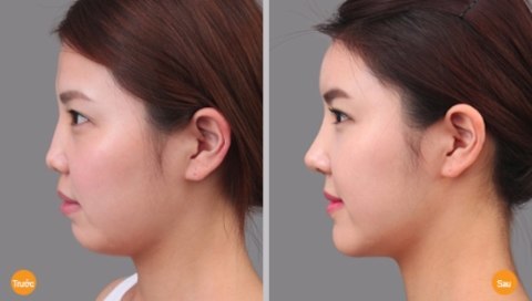 THẠC SĨ BÁC SĨ HUỲNH PHÁT