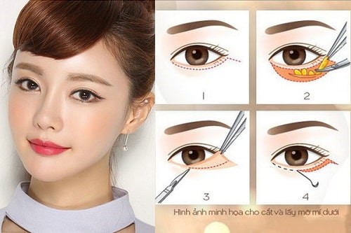THẠC SĨ BÁC SĨ HUỲNH PHÁT