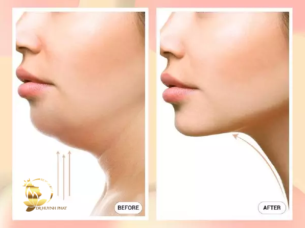 THẠC SĨ BÁC SĨ HUỲNH PHÁT