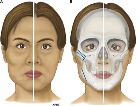 THẠC SĨ BÁC SĨ HUỲNH PHÁT