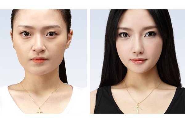 THẠC SĨ BÁC SĨ HUỲNH PHÁT