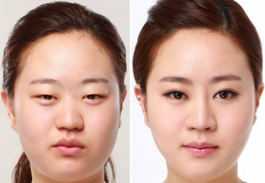 THẠC SĨ BÁC SĨ HUỲNH PHÁT