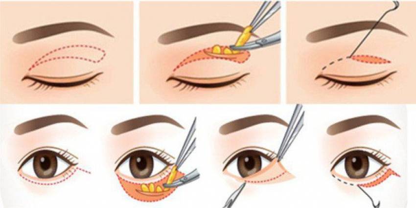 THẠC SĨ BÁC SĨ HUỲNH PHÁT