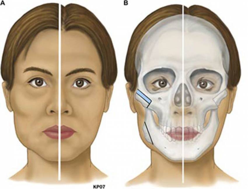 THẠC SĨ BÁC SĨ HUỲNH PHÁT