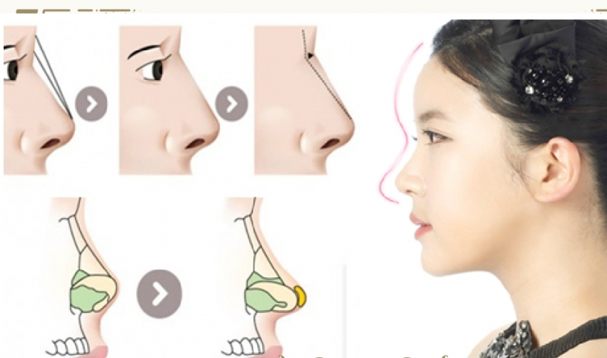 THẠC SĨ BÁC SĨ HUỲNH PHÁT