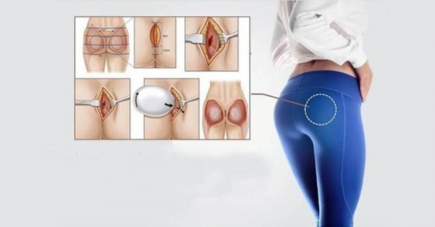 THẠC SĨ BÁC SĨ HUỲNH PHÁT