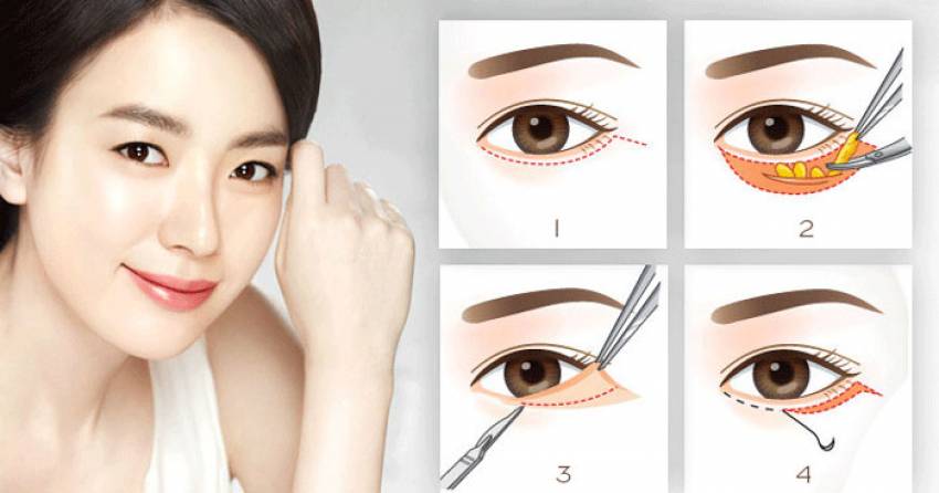 THẠC SĨ BÁC SĨ HUỲNH PHÁT