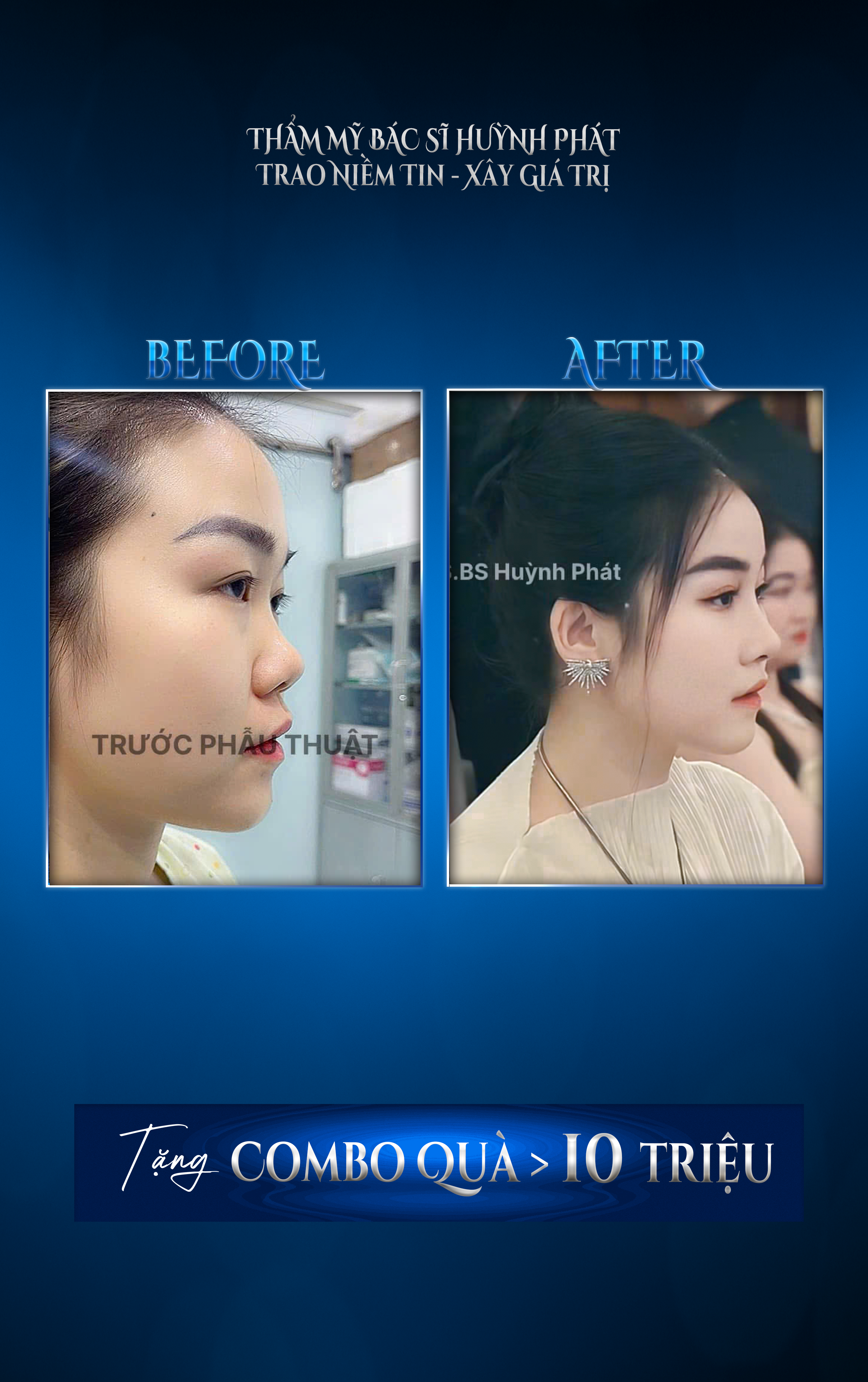 THẠC SĨ BÁC SĨ HUỲNH PHÁT