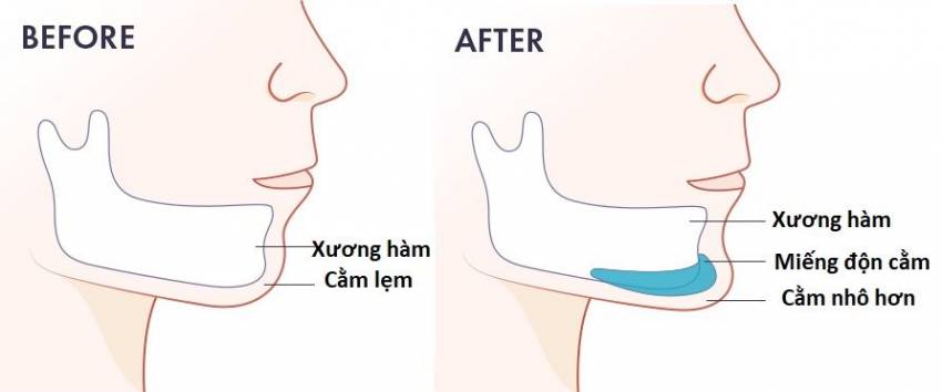 THẠC SĨ BÁC SĨ HUỲNH PHÁT