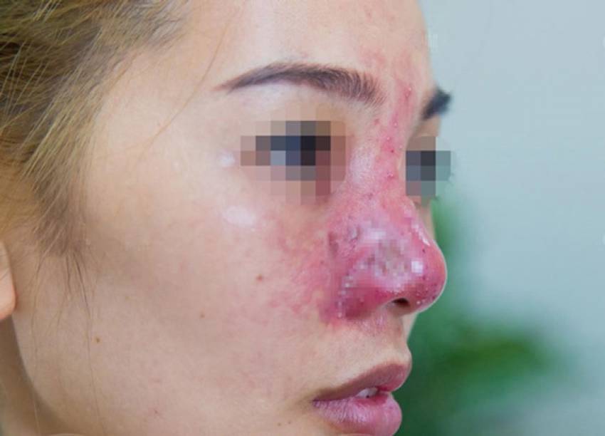 THẠC SĨ BÁC SĨ HUỲNH PHÁT