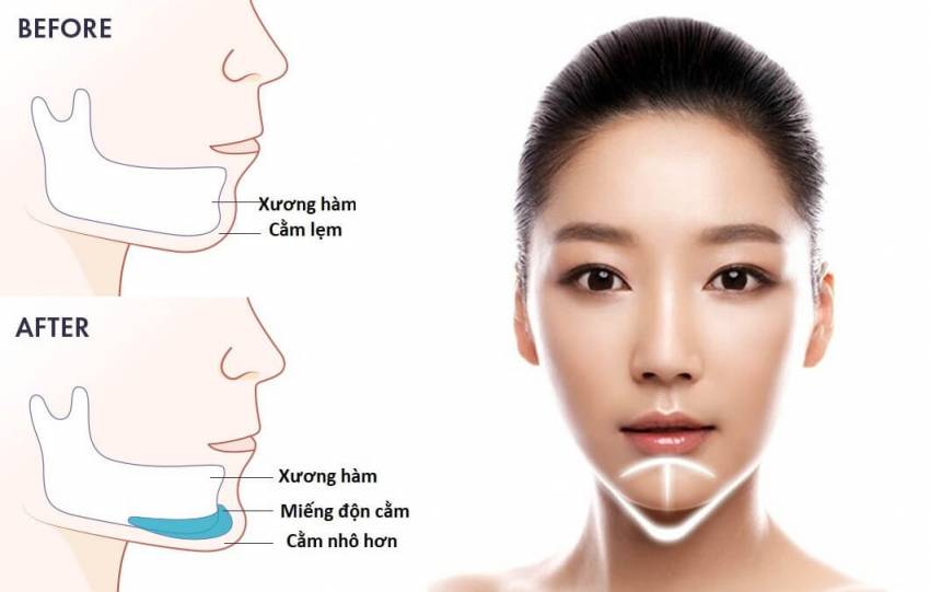 THẠC SĨ BÁC SĨ HUỲNH PHÁT