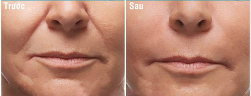THẠC SĨ BÁC SĨ HUỲNH PHÁT