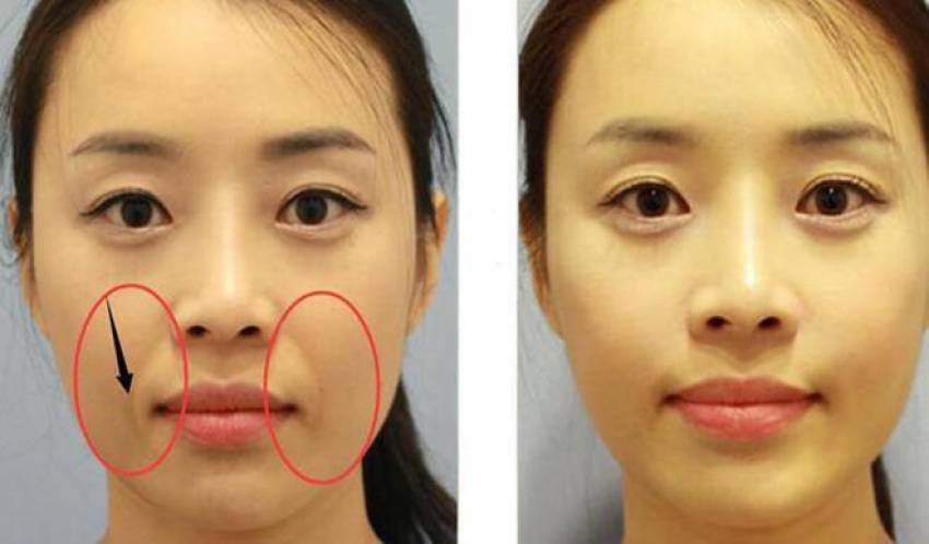 THẠC SĨ BÁC SĨ HUỲNH PHÁT