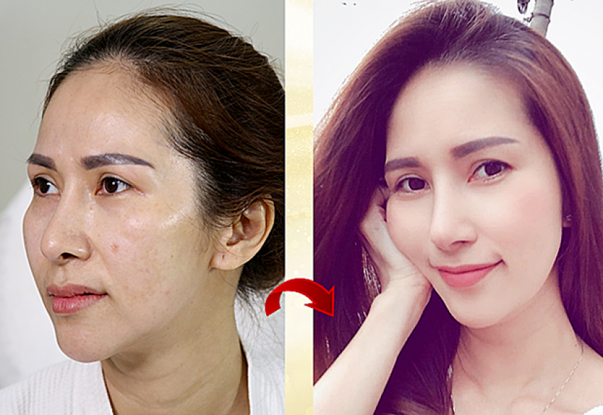 THẠC SĨ BÁC SĨ HUỲNH PHÁT