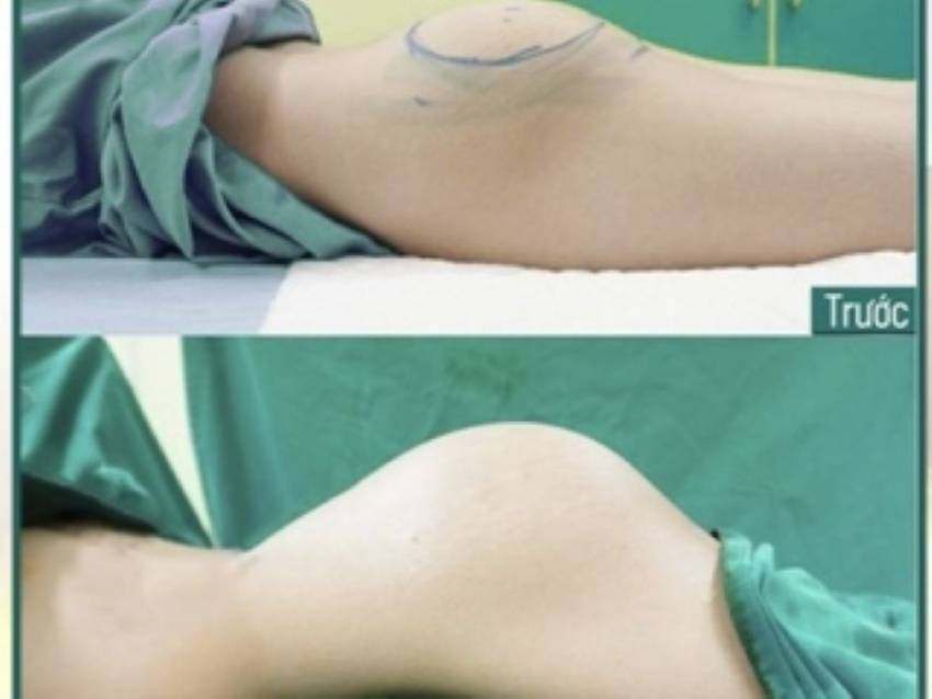 THẠC SĨ BÁC SĨ HUỲNH PHÁT