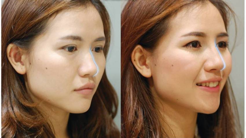 THẠC SĨ BÁC SĨ HUỲNH PHÁT
