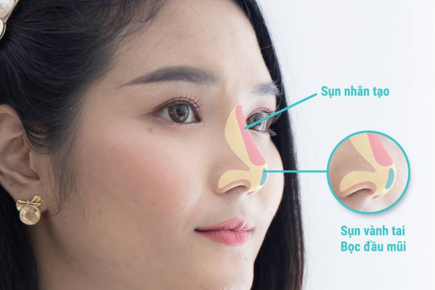 THẠC SĨ BÁC SĨ HUỲNH PHÁT