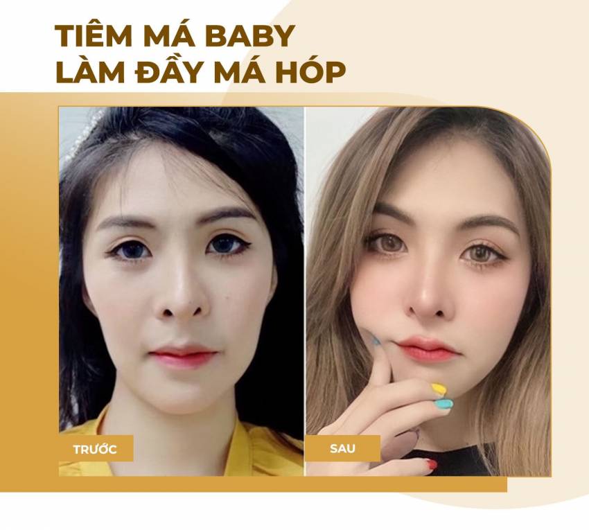 THẠC SĨ BÁC SĨ HUỲNH PHÁT