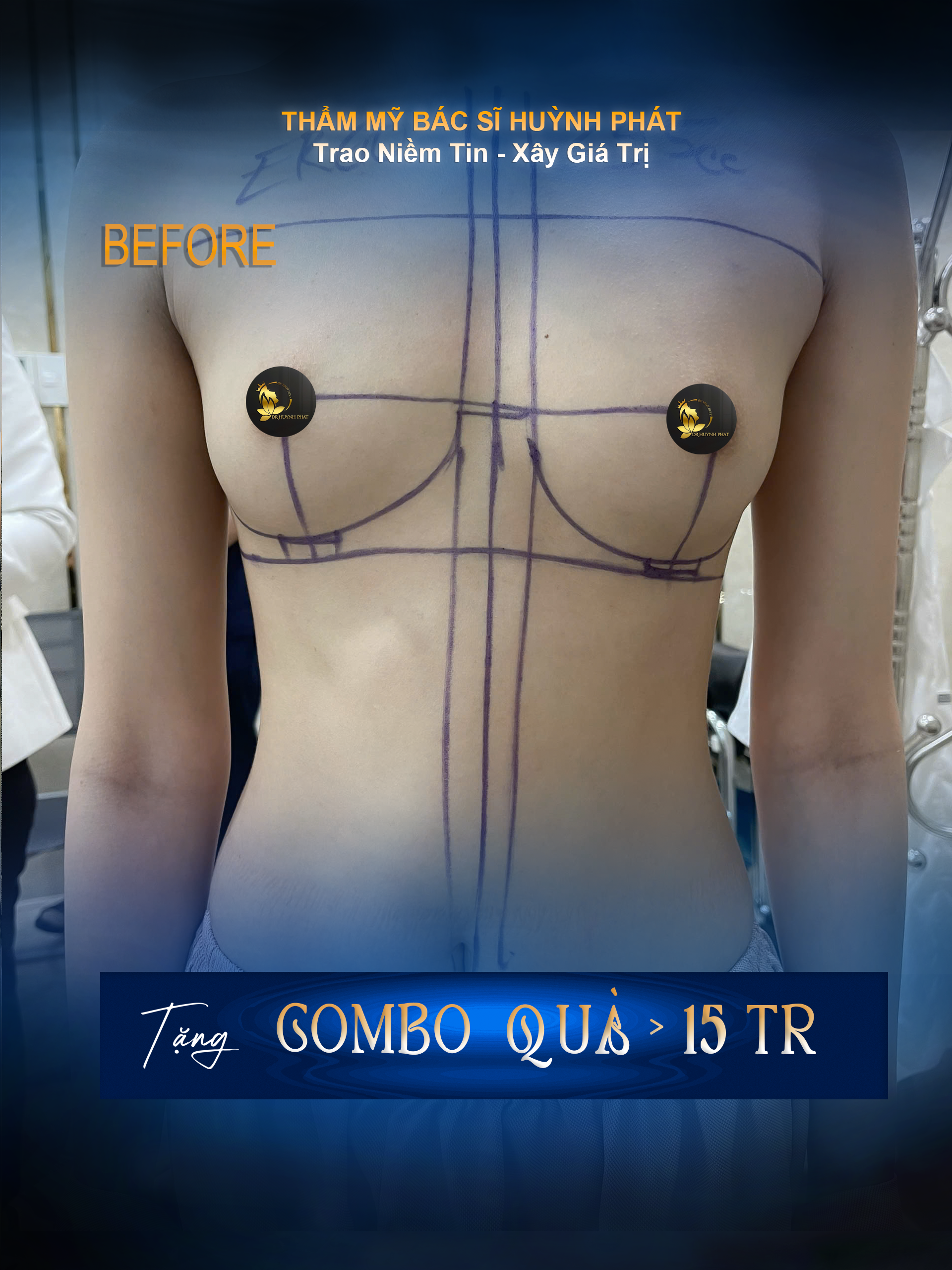 THẠC SĨ BÁC SĨ HUỲNH PHÁT