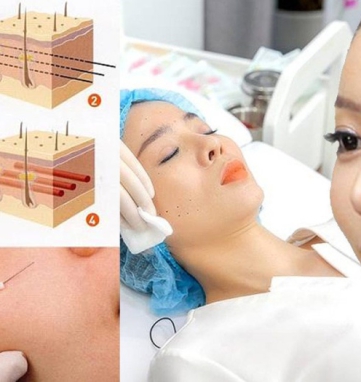 bác sĩ căng da mặt giỏi tại Sài Gòn