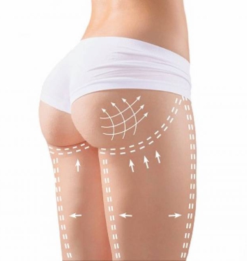 Brazilian butt lift surgeon in Vietnam