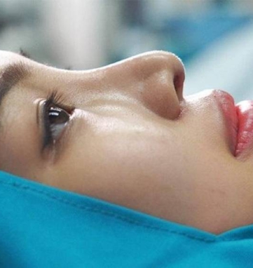 nâng mũi cấu trúc tại Sài Gòn