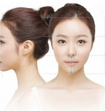 natural rhinoplasty in Ho Chi Minh City