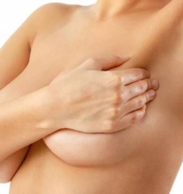 mastopexy surgeon in Vietnam