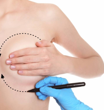 breast lift in Saigon Vietnam