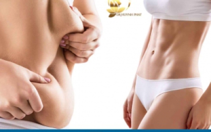 Hút Mỡ Điêu Khắc Body là gì? - 5 lưu ý cần tư vấn từ Bác sĩ Huỳnh Phát