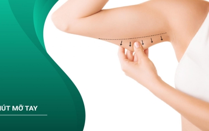 Hút Mỡ Bắp Tay - Những Điều Cần Biết và Lưu Ý