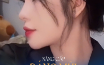 Nâng Mũi Chỉ Collagen: Toàn Bộ Thông Tin Cần Biết Trước Khi Thực Hiện