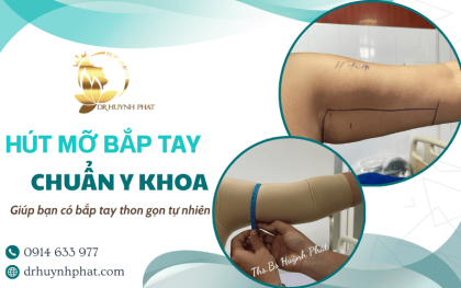 Dịch vụ hút mỡ bắp tay chuẩn y khoa, dáng tay thon gọn tự nhiên