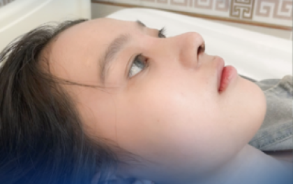 Thẩm Mỹ Mũi: Giải Pháp Toàn Diện Cho Dáng Mũi Hoàn Hảo Từ A-Z