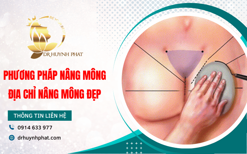 phương pháp nâng mông