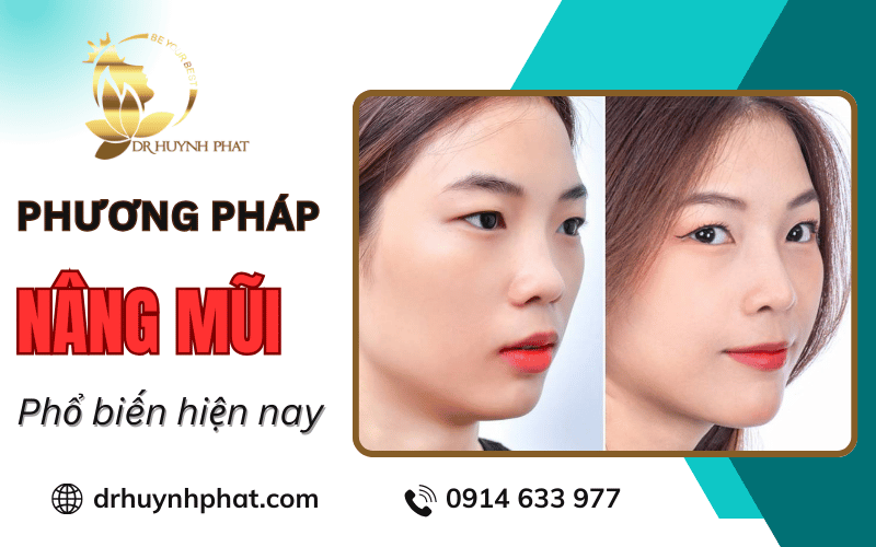 các phương pháp nâng mũi
