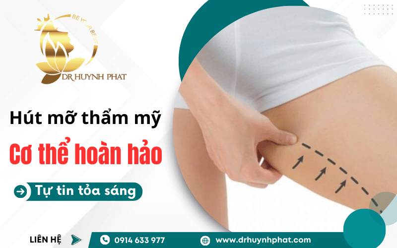 các vùng trên cơ thể có thể hút mỡ