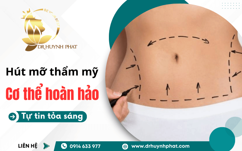 các vùng cơ thể có thể hút mỡ