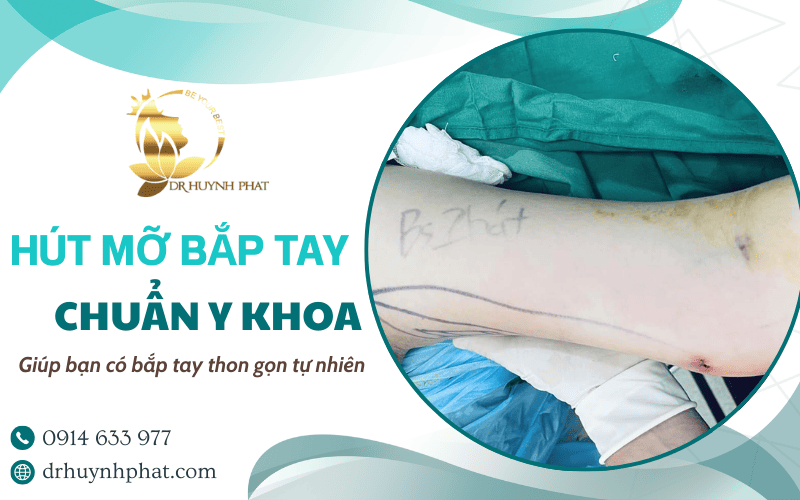 dịch vụ hút mỡ bắp tay