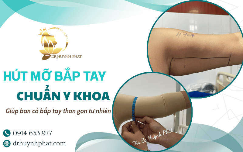 dịch vụ hút mỡ bắp tay
