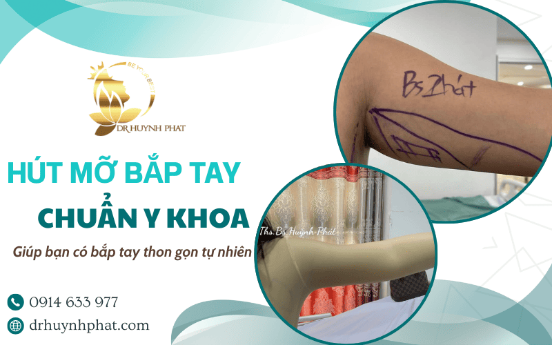 dịch vụ hút mỡ bắp tay